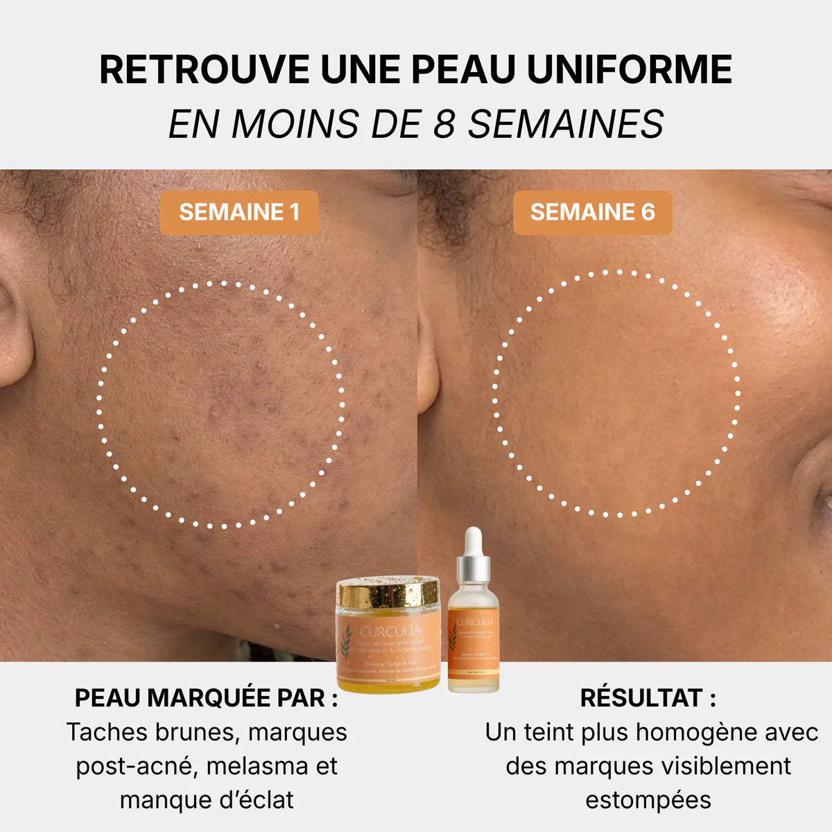 Routine Anti imperfections
